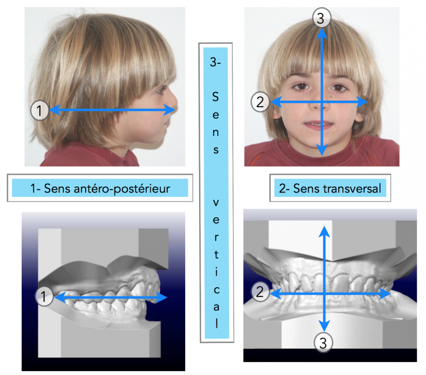 Diagnostic et plan de traitement Orthodontiste